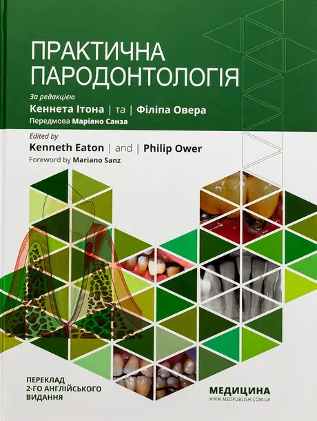 Книга «Практична пародонтологія»